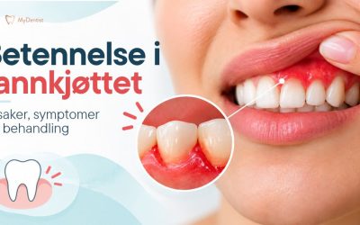 Betennelse i tannkjøttet – Årsaker, symptomer og behandling